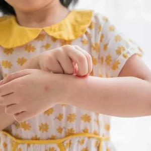 تولید لباس مناسب پوست حساس کودک