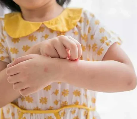 تولید لباس مناسب پوست حساس کودک