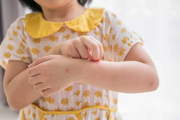 تولید لباس مناسب پوست حساس کودک